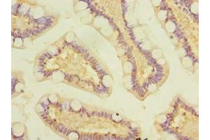 Immunohistochemistry of paraffin-embedded human small intestine tissue using ABIN7163860 at dilution of 1:100 (GALNT12 anticorps  (AA 1-272))