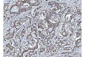 IHC analysis of FEN1 using anti-FEN1 antibody (ABIN7601619). (FEN1 anticorps  (AA 4-300))