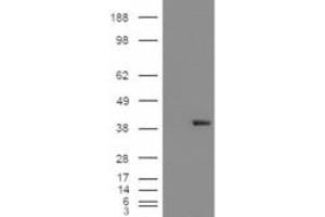 Western Blotting (WB) image for anti-Aldo-Keto Reductase Family 1, Member B1 (Aldose Reductase) (AKR1B1) antibody (ABIN5912019) (AKR1B1 anticorps)