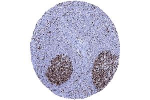 In lymph nodes a particularly strong MCM7 staining occurs in most cells of germinal centres