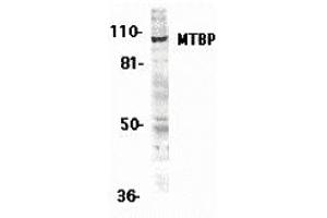 Western Blotting (WB) image for anti-MDM2 Binding Protein (MTBP) (Middle Region 2) antibody (ABIN1031200)