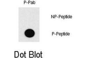 Dot blot analysis of MEF2C (phospho T20) polyclonal antibody  on nitrocellulose membrane.