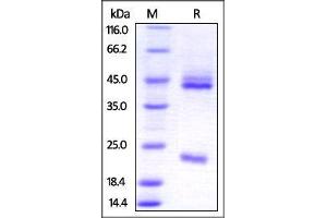 Human IL-23 alpha & IL-12 beta Heterodimer Protein on SDS-PAGE under reducing (R) condition. (IL12A & IL27B (AA 20-189) (Active) protein (His tag))