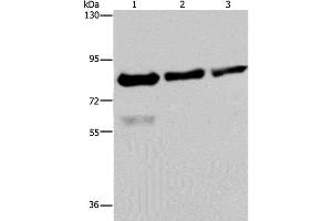 Western Blot analysis of Hela, LoVo and HepG2 cell using FASTKD2 Polyclonal Antibody at dilution of 1:500 (FASTKD2 anticorps)