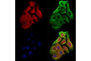 ABIN6263918 and ABIN6273062 staining Hela cells by IF/ICC. (OTUD7B anticorps  (C-Term))