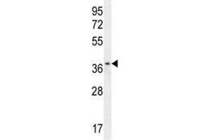 ZNF322B antibody western blot analysis in HL-60 lysate (ZNF322P1 anticorps  (AA 326-354))