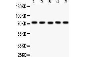 Western Blotting (WB) image for anti-Embryonic Ectoderm Development (EED) (AA 256-441) antibody (ABIN3043370)