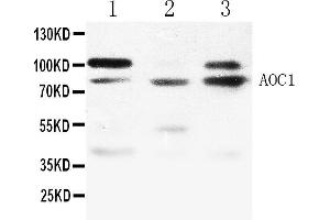 Western blot analysis of ABP1 expression in NRK whole cell lysates ( Lane 1), 293T whole cell lysates ( Lane 2) and MCF-7 whole cell lysates ( Lane 3). (DAO anticorps  (N-Term))