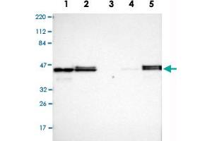Western Blot analysis of Lane 1: RT-4, Lane 2: U-251MG sp, Lane 3: human plasma (IgG/HSA depleted), Lane 4: human liver and Lane 5: human tonsil lysates with VASP polyclonal antibody . (VASP anticorps)