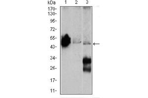 Western blot analysis using ENO2 antibody against Mouse brain (1), NIH3T3 (2), and C6 (3) cell lysate. (ENO2/NSE anticorps  (AA 251-433))