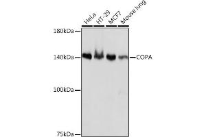 Western blot analysis of extracts of various cell lines, using COPA Rabbit mAb (ABIN7266423) at 1:1000 dilution. (COPA anticorps)