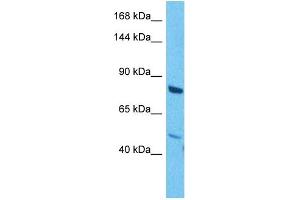 Host:  Rabbit  Target Name:  MAP3K1  Sample Tissue:  Human Jurkat Whole Cell  Antibody Dilution:  1ug/ml