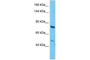 Host:  Rabbit  Target Name:  MAP3K1  Sample Tissue:  Human Jurkat Whole Cell  Antibody Dilution:  1ug/ml (MAP3K1 anticorps  (C-Term))