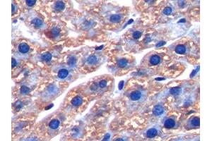 DAB staining on IHC-P; Samples: Rat Liver Tissue (FTH1 anticorps  (AA 1-182))