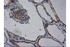 Immunohistochemical staining of paraffin-embedded Human thyroid tissue using anti-EIF4E2 mouse monoclonal antibody. (EIF4E2 anticorps)