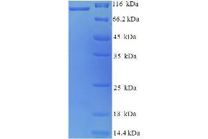 SDS-PAGE (SDS) image for Antigen P97 (Melanoma Associated) Identified By Monoclonal Antibodies 133.2 and 96.5 (MFI2) (AA 20-710), (partial) protein (His-SUMO Tag) (ABIN5709929)