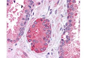 Immunohistochemistry (IHC) image for anti-Signal Transducer and Activator of Transcription 3 (Acute-Phase Response Factor) (STAT3) (N-Term) antibody (ABIN2780479)