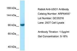 Western Blotting (WB) image for anti-USO1 Homolog, Vesicle Docking Protein (USO1) (C-Term) antibody (ABIN971980) (USO1 anticorps  (C-Term))