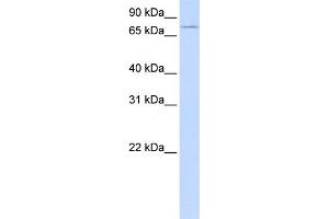 WB Suggested Anti-UBASH3A Antibody Titration:  0. (UBASH3A anticorps  (Middle Region))