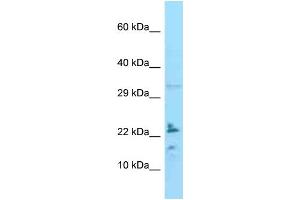 WB Suggested Anti-IL24 Antibody Titration: 1. (IL-24 anticorps  (C-Term))