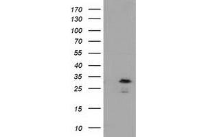 Western Blotting (WB) image for anti-RASD Family, Member 2 (RASD2) antibody (ABIN1500695) (RASD2 anticorps)