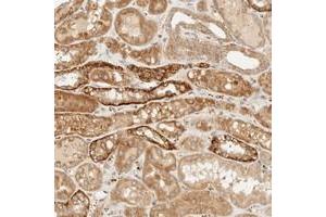 Immunohistochemical staining of human kidney with KLF17 polyclonal antibody  shows strong cytoplasmic positivity in distal tubules at 1:200-1:500 dilution. (KLF17 anticorps)