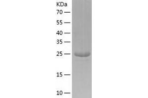 Western Blotting (WB) image for Polybromo 1 (PBRM1) (AA 53-345) protein (His-IF2DI Tag) (ABIN7124509)