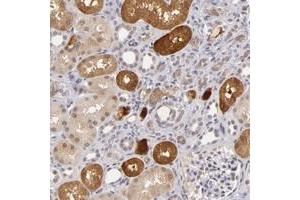 Immunohistochemical staining of human kidney with ZNF205 polyclonal antibody  shows cytoplasmic positivity in cells in tubules at 1:20-1:50 dilution. (ZNF205 anticorps)