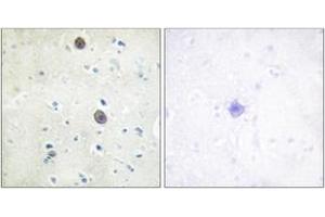 Immunohistochemistry analysis of paraffin-embedded human brain, using Amyloid beta A4 (Phospho-Thr743/668) Antibody. (APP anticorps  (pThr743))