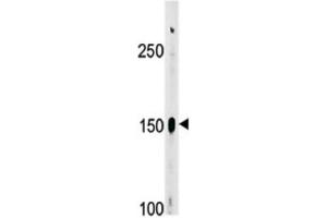Western Blotting (WB) image for anti-C-Abl Oncogene 1, Non-Receptor tyrosine Kinase (ABL1) (pTyr412) antibody (ABIN3001744) (ABL1 anticorps  (pTyr412))