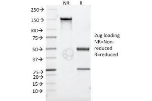 SDS-PAGE Analysis Purified CD30 Monoclonal Antibody (Ki-1/779). (TNFRSF8 anticorps)