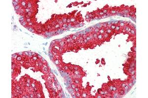 Anti-ELMO3 antibody IHC staining of human prostate. (ELMO3 anticorps  (AA 760-773))