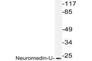 Western blot (WB) analysis of Neuromedin-U in extracts from HepG2 cells with AP21204PU-N. (Neuromedin U anticorps)