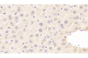 Detection of C8b in Mouse Liver Tissue using Polyclonal Antibody to Complement Component 8b (C8b)