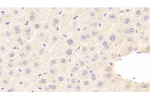 Detection of C8b in Mouse Liver Tissue using Polyclonal Antibody to Complement Component 8b (C8b) (C8B anticorps  (AA 161-503))