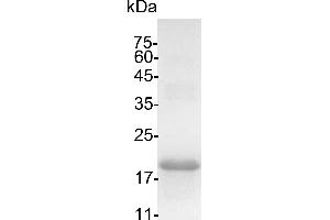 Interleukin 10 (IL10) (Active) protein (His tag)