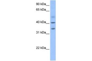 Western Blotting (WB) image for anti-Zinc Finger CCCH-Type Containing 14 (ZC3H14) antibody (ABIN2463623) (ZC3H14 anticorps)