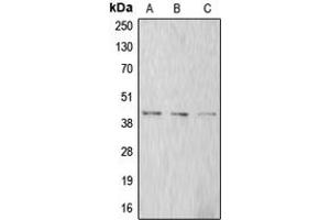 Western blot analysis of Alpha-actin-1 expression in A549 (A), SP2/0 (B), rat kidney (C) whole cell lysates.