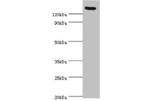 Western blot All lanes: SPAG5 antibody at 2 μg/mL Secondary Goat polyclonal to rabbit IgG at 1/10000 dilution Predicted band size: 134 kDa Observed band size: 134 kDa (SPAG5 anticorps  (AA 1-300))