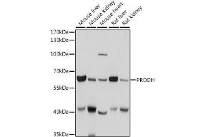 Western blot analysis of extracts of various cell lines, using PRODH antibody (ABIN6128506, ABIN6146242, ABIN6146243 and ABIN6221531) at 1:1000 dilution. (PRODH anticorps  (AA 321-600))