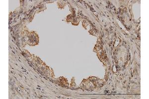 Immunoperoxidase of monoclonal antibody to PAK1 on formalin-fixed paraffin-embedded human prostate. (PAK1 anticorps  (AA 191-280))
