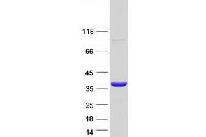 Validation with Western Blot