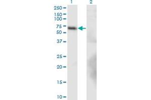 Western Blot analysis of BTBD9 expression in transfected 293T cell line by BTBD9 monoclonal antibody (M02), clone 1G3. (BTBD9 anticorps  (AA 2-70))