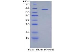 SDS-PAGE of Protein Standard from the Kit (Highly purified E. (Amphiregulin Kit ELISA)