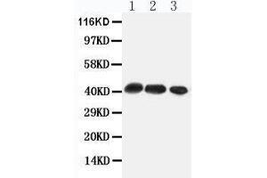 Anti-CCR4 antibody, Western blotting All lanes: Anti CCR4  at 0.