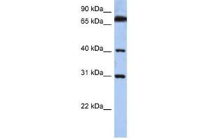 DHRSX antibody used at 0. (DHRSX anticorps  (C-Term))