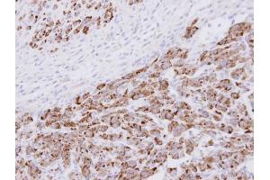 IHC-P Image Immunohistochemical analysis of paraffin-embedded U87 xenograft , using 20S Proteasome alpha3 , antibody at 1:100 dilution. (PSMA3 anticorps  (Center))