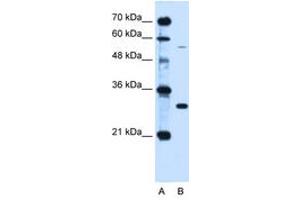 Image no. 2 for anti-Hemochromatosis (HFE) (AA 149-198) antibody (ABIN6736669) (HFE anticorps  (AA 149-198))