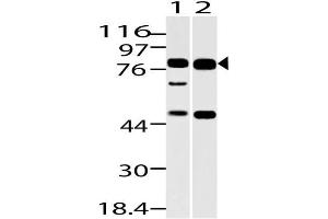 Image no. 1 for anti-Dachshund 1 (DACH1) (AA 300-550) antibody (ABIN5027130) (DACH1 anticorps  (AA 300-550))