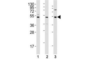 Western blot testing of LAG3 antibody at 1:2000 dilution tested on human lysates, Lane 1: K562